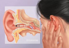 成都耳鼻喉醫院教你正確認識傳導性耳鳴及時治療