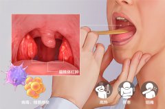 兒童扁桃體發炎發燒怎么辦？成都仁品耳鼻喉醫院解答
