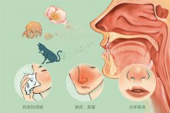 掌握4大因素讓過敏性鼻炎遠離兒童！