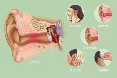 外耳道炎要如何治療才好？成都耳鼻喉醫院解答